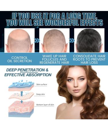 # Anti Fall Dense Hair Essences Thick Hairline Moisturizing Dry Hair Repairs Hair Root Nourishing Hair Dense Hair Essences 60ml (White One Size) One Size White - Buy Online on GoSupps.com