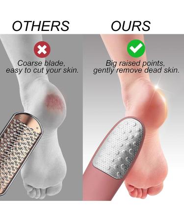 Never-Cut-Your-Feet Foot Scrubber | Callus Remover with Stand | Safe & Comfortable Dead Skin Remover | Best Home Pedicure Tool for Wet/Dry Feet - Buy Online on GoSupps.com