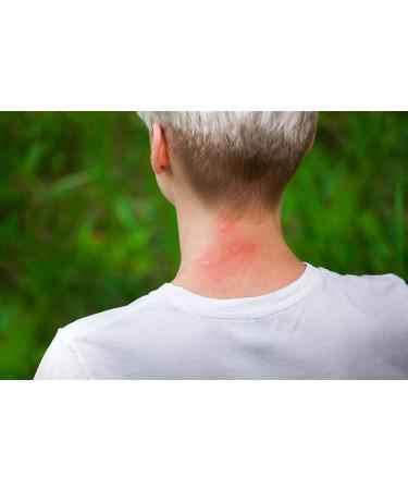 Plantain Salve 4oz - Natural Healing Balm for Skin Relief - Buy Online on GoSupps.com