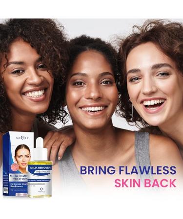 Milia Remover 30 ML - Dissolves and Reduces Milia  Whiteheads  and Sebaceous Hyperplasia - Buy Online on GoSupps.com