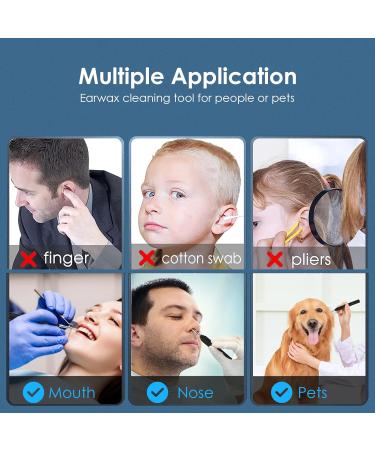 Ear Wax Removal Tool Camera - 1080P Otoscope Ear Cleaning Kit with Light & 7 Picks - Wireless Earwax Remover for iPhone & Android - Best Ear Cleaner (Black - Buy Online on GoSupps.com