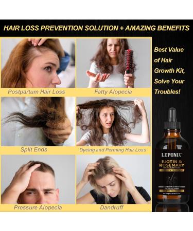 Rosemary Oil for Hair Growth Diluted Rosemary Oil for Hair w/Derma Roller Promotes Thicker Hair and Scalp Nourishment Hair Loss Treatment for men and Women Rosemary Biotin - Buy Online on GoSupps.com