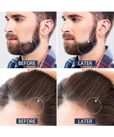 Zynxel Derma Roller 0.5mm Hair Dermaroller Micro Needle Roller for Stimulating Hair and Beard Growth - Buy Online on GoSupps.com