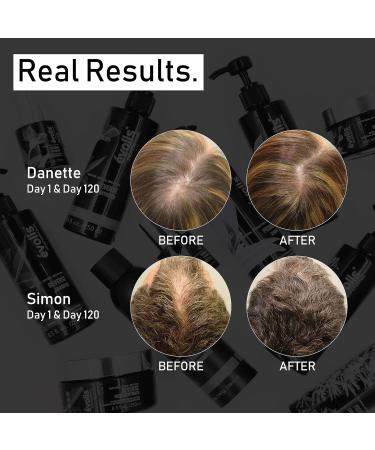 Évolis Prevent Anti-Aging Conditioner | Natural Anti-Hair Loss Treatment for Men & Women | Ideal for Sensitive Scalp & Oily Hair | 8.5 fl oz - Buy Online on GoSupps.com