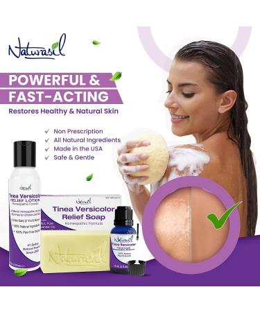 All Natural Tinea Versicolor Treatment Kit - Gentle Sulfur Lotion & Relief Soap - Fast & Effective for Discoloration  Itching  Irritation - Safe for All Skin Types & Ages - 4oz - Buy Online on GoSupps.com