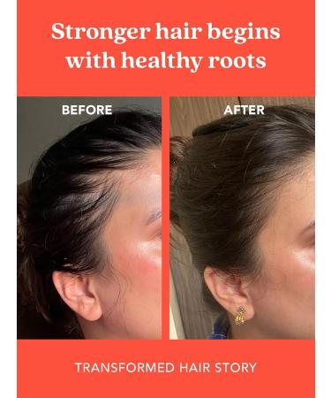 Buy THE LIVING CO Shikakai + Bhringraj Hair Oil for Growth - 100ml | Best International Shipping - Buy Online on GoSupps.com