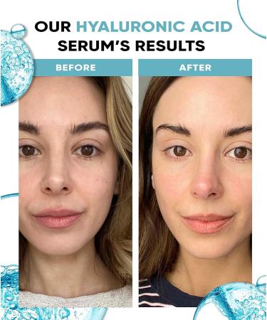 Hyaluronic Acid Serum - Skincare Moisturiser with Vitamin B5 and Aloe Vera - Face Moisturiser to Plump Hydrate and Smooth Skin for Women and Men All Skin Types 30ml - Buy Online on GoSupps.com