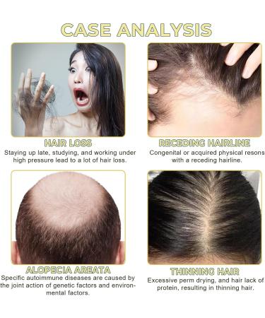  Lxitian Natural Hair Growth Oil 100% Natural Hair Oils with Green Coffee Coconut Oil Castor Oil Argan Oil and Rosemary Oil to Encourage Thickening - Buy Online on GoSupps.com