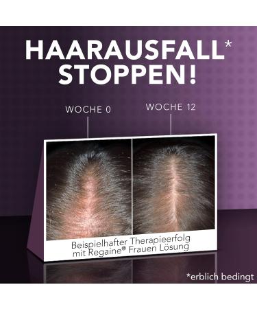 Regaine Women Solution with 20 mg/ml Minoxidil - Stops Hereditary Hair Loss & Stimulates New Growth | 3x60 ml Pack - Buy Online on GoSupps.com