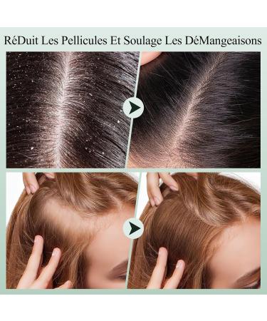 Gommage du cuir chevelu shampooing exfoliant pour cuir chevelu au romarin traitement 2 en 1 du cuir chevelu l'huile de menthe traitement capillaire pour clarifier et enlever l'accumulation avec - Buy Online on GoSupps.com