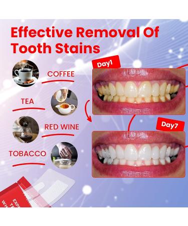 Professional Teeth Whitening Strips 6% HP - 56 Pcs, 28 Treatments for Sensitive Teeth - Non-Slip White Strips for Fast Stain Removal - Buy Online on GoSupps.com