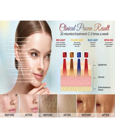FDA Cleared LED Light Therapy Face Mask for Anti-Aging & Dark Spot Removal + Ice Roller - 8-in-1 Rejuvenation Device - Buy Online on GoSupps.com