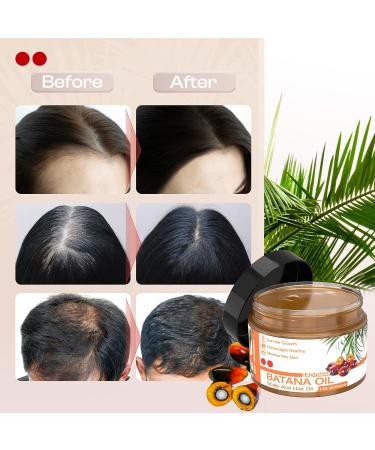 SADOWAY Batana Oil for Hair Growth Organic Oil to Prevent Hair Loss & Moisturize Scalp for Men & Women - International Shipping Available - Buy Online on GoSupps.com