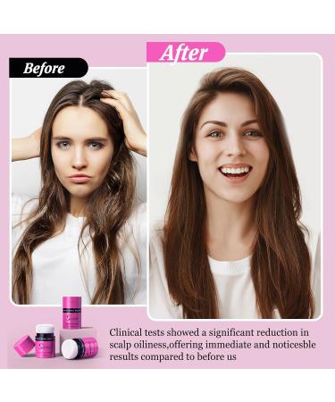 Dry Shampoo Powder - Volumizing & Mattifying Travel Size | No White Cast Non Aerosol Hair Care for All Hair Colors - Buy Online on GoSupps.com