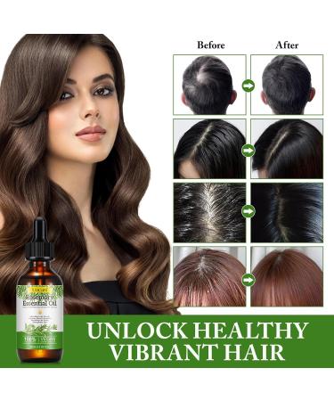 Uocasi Hair Growth Oil - 2 Pack Rosemary Essential Oil Serum (120ML) | 100% Pure Natural Formula to Prevent Hair Loss Slow Graying Enhance Luster & Reduce Dandruff - Buy Online on GoSupps.com