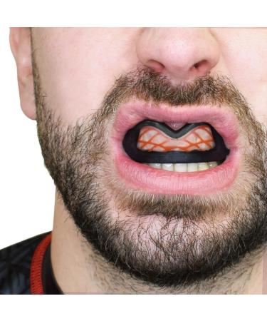 Safejawz Nitro Mouthguard for Adults & Juniors - Ultimate Protection for Boxing Basketball Lacrosse MMA & More | Includes Case - Black - Buy Online on GoSupps.com