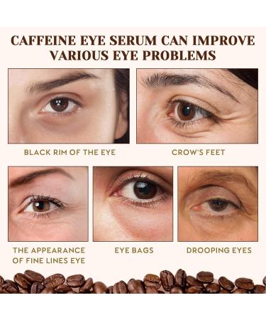 Trendyfave Caffeine Eye Serum Caffeine Solution 5% + EGCG Under Eye Cream for Dark Circles and Puffy Eyes Fade Fine Line Eye Bag Removal Anti Aging Eye Serum 30ml - Buy Online on GoSupps.com