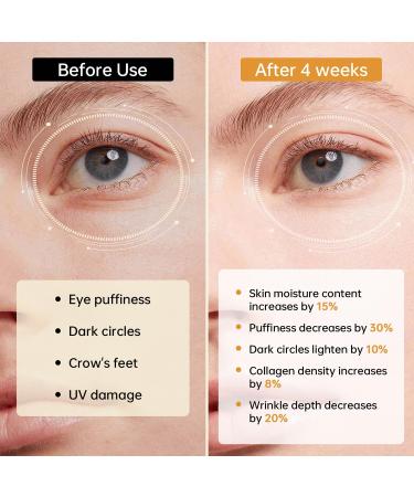 5% Caffeine Eye Serum with 360 Roller Under Eye Cream for Dark Circles Puffiness & Puffy Bags Wrinkles Fine Lines Eyes Cream for Men and Women 0.51 fl oz - Buy Online on GoSupps.com