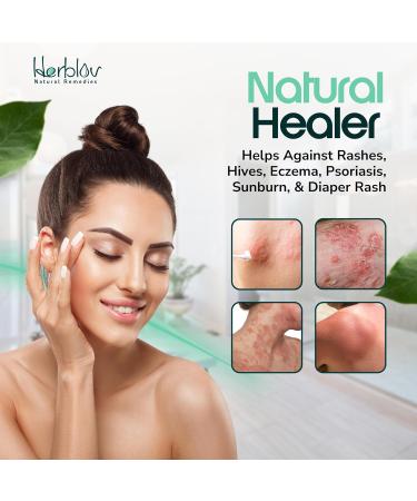 Beef Tallow Balm - Natural Grass Fed Whipped Tallow & Honey - Moisturizing All-Purpose Lotion for Eczema Dry Skin & Irritation - Made in USA - Buy Online on GoSupps.com