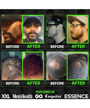 Beard Growth Kit w/Grow 11-in-1 Hair Growth Shampoo for Men & Conditioner w/Biotin + Beard Growth Vitamins & Hair Growth Vitamins for Men + 6X Liquid Biotin with Collagen - Formulated in America - Buy Online on GoSupps.com