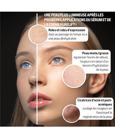 Snail Slime Moisturizing Face Serum 98% - Powerful Anti-Wrinkle With Hyaluronic Acid Vitamin E Vitamin C Regenerating Aloe Vera - Skincare for Women and Men 100 ML - FITOATTIVI - Buy Online on GoSupps.com