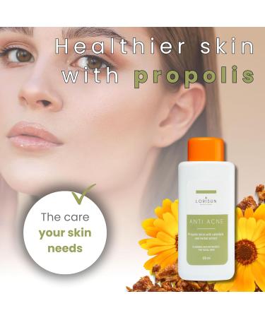 Lorisun Anti Acne Lotion with Propolis and Calendula | Treatment of Severe Acne | Anti Acne Face | Cleanses and Purifies the Skin | 120ml - Buy Online on GoSupps.com