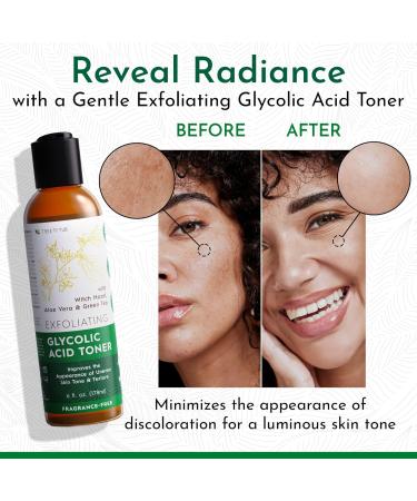 Tree to Tub Glycolic Acid Toner - Vegan Exfoliating Face Toner with Witch Hazel & Aloe Vera | Smooth Skin & Brightens | Unscented 6 Fl Oz - Buy Online on GoSupps.com
