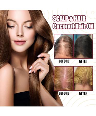  GNAUMORE Onion Hair Oil Essence for Hair Growth Fast Growth Hair Serum Anti-Hair Loss Serum for Women and Men Hair Regrowth Treatments 30 ml - Buy Online on GoSupps.com