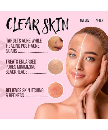 Beauty Bar Matcha Green Tea Mask Stick - Blackhead & Acne Treatment, Dark Spot Remover, Pore Cleanser, 40g - Buy Online on GoSupps.com