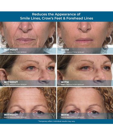 Plexaderm Eye Serum Pods - Instant Anti-Aging for Bags, Dark Circles & Wrinkles - Buy Online on GoSupps.com