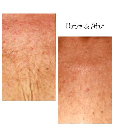 Buy Kami Pure Silicone Gel Anti-Wrinkle Chest Patch - Hydrate & Plump Skin Botox Alternative Single Pack for Anti-Aging Solution - Buy Online on GoSupps.com