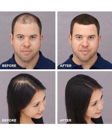 Toppik Hair Building Fibers 3g - Instant Hair Thickness & Volume | Buy Internationally - Buy Online on GoSupps.com