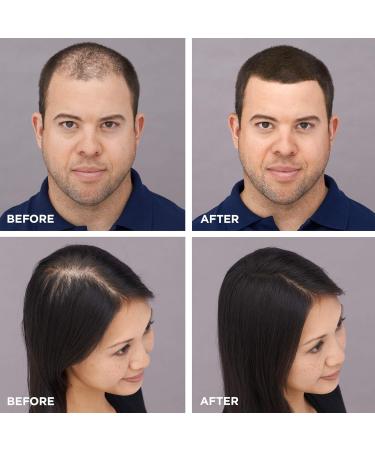 Toppik Hair Building Fibers 12g Fill In Fine or Thinning Hair Instantly Thicker Fuller Looking Hair 9 Shades for Men & Women Light Blonde - Buy Online on GoSupps.com