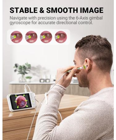 Anykit Digital Otoscope with Gyroscope, 4 Inches Screen, 3.9mm Ear Scope Camera with 6 Lights, Ear Wax Removal Tool, 32GB Card, Supports Photo Snap and Video Recording - Buy Online on GoSupps.com