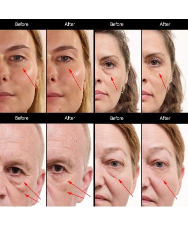 Puffy Eyes Treatment with Hydrating Eye Cream - Instantly Eliminate Wrinkles, Puffiness, Dark Circles, and Bags - SEAMANTIKA .8 oz - Buy Online on GoSupps.com