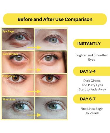Under Eye Patches - 60 Pcs | Anti-Aging Collagen Eye Mask for Dark Circles Puffiness & Wrinkles - Refresh Your Skin - Buy Online on GoSupps.com