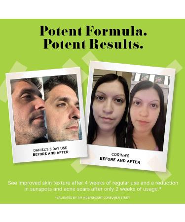No B.S. Anti Aging Caffeine Eye Cream Bundle with 2 Retinol Minis | Dark Circles & Puffiness Treatment for Eyes | Includes Retinol Cream for Wrinkles - Buy Online on GoSupps.com