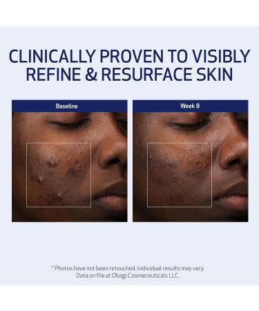 Obagi Medical Retinol + PHA Refining Night Cream - Clinically Proven Dual-Action Overnight Anti-Aging Face Cream for Smoother Renewed Skin & a More Even-Looking Complexion - 1.7 Oz - Buy Online on GoSupps.com