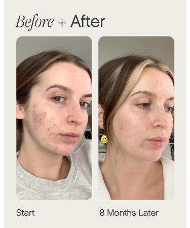 Faded Serum for Dark Spots & Discoloration, Tranexamic Acid & Niacinamide Formula - 1.7 Fl Oz - Buy Online on GoSupps.com