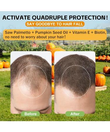 Well&Whole Pumpkin Seed Oil for Hair Growth, Pumpkin Seed Oil Gummies with Saw Palmetto for Men and Women, Prostate Health & Urinary Tract Support, Vegan, Sugar-Free, 60 Counts - Buy Online on GoSupps.com