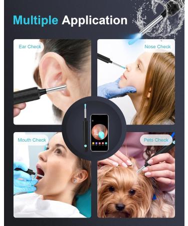 DJROLL Ear Wax Removal Tool - HD 1080P Wireless Ear Camera Otoscope for iOS & Android | Ear Wax Remover with 6 LED Lights - Best Ear Care Solution (Black - Buy Online on GoSupps.com