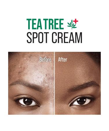 KISS New York Tea Tree Spot Cream - Lightweight Korean Skincare for Blemishes | International Shipping - Buy Online on GoSupps.com