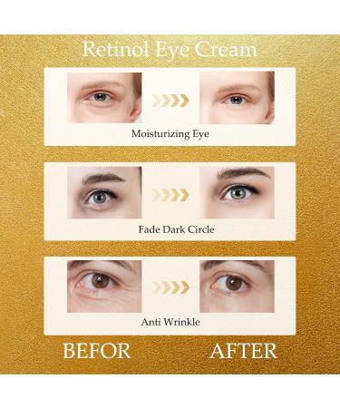 Retinol Dark Circle Eye Cream - Eye Cream for Eye Bags Remover - Eye Cream Anti Aging - Fade Lines Moisturizes around Eyes - Anti Wrinkle and Leave Eye Skin Smooth - Buy Online on GoSupps.com