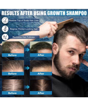 Xionghonglong Hair growth shampoo shampoo for men 100ml Shampoo against hair loss Promotes hair growth Strengthens the hair roots Cleans and cares for the scalp Reduces hair breakage and hair loss - Buy Online on GoSupps.com