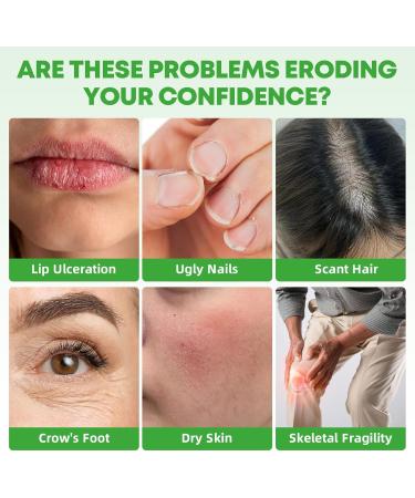 BIYODE L-Lysine Gummies with 1000mg: Lip & Skin Wellness with Vitamin C Zinc CoQ10 Hyaluronic Acid Sugar-Free Vegan Pectin Non-GMO Natural Watermelon Flavor 60 Gummies 30-Day Supply - Buy Online on GoSupps.com