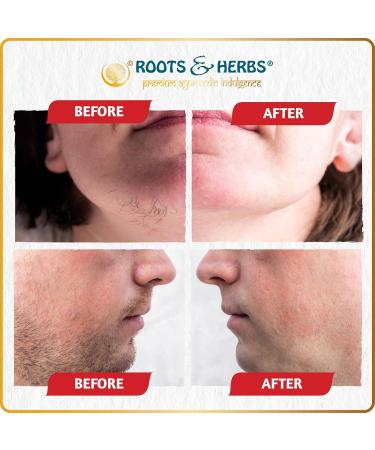 Chickpea & Kasturi Turmeric Facial Hair Removal Powder - Ayurvedic Depilatory Mask for Men & Women - Effective for Chin Jawline & Upper Lips - 2.11oz Roots & Herbs - Buy Online on GoSupps.com