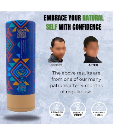 Scalp Revitalizing Ayurvedic Hair Oil | Natural Herbal Treatment for Hair Fallout & Scalp Care | 100% Natural Hair Care - Buy Online on GoSupps.com