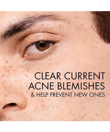 Vichy Normaderm Daily Acne Face Wash with Salicylic Acid | Cleanser for Oily & Acne Prone Skin | Clears Pores & Blackheads | Sensitive Skin Cleansing Gel | 6.7 Fl Oz - Buy Online on GoSupps.com