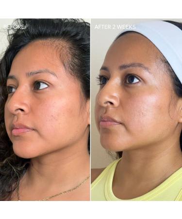 Dermisa Skin Fade Cream with Vitamin C | Helps Reduce Dark Spots and Age Spots | All Skin Types | 1.78 OZ | Pack of 1 1.78 Ounce (Pack of 1) - Buy Online on GoSupps.com