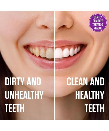 Buy SprinJene Fluoride Free Toothpaste for Sensitive Teeth - All Natural & SLS Free - 2 Pack (5oz Each) - Perfect for Adults - Buy Online on GoSupps.com